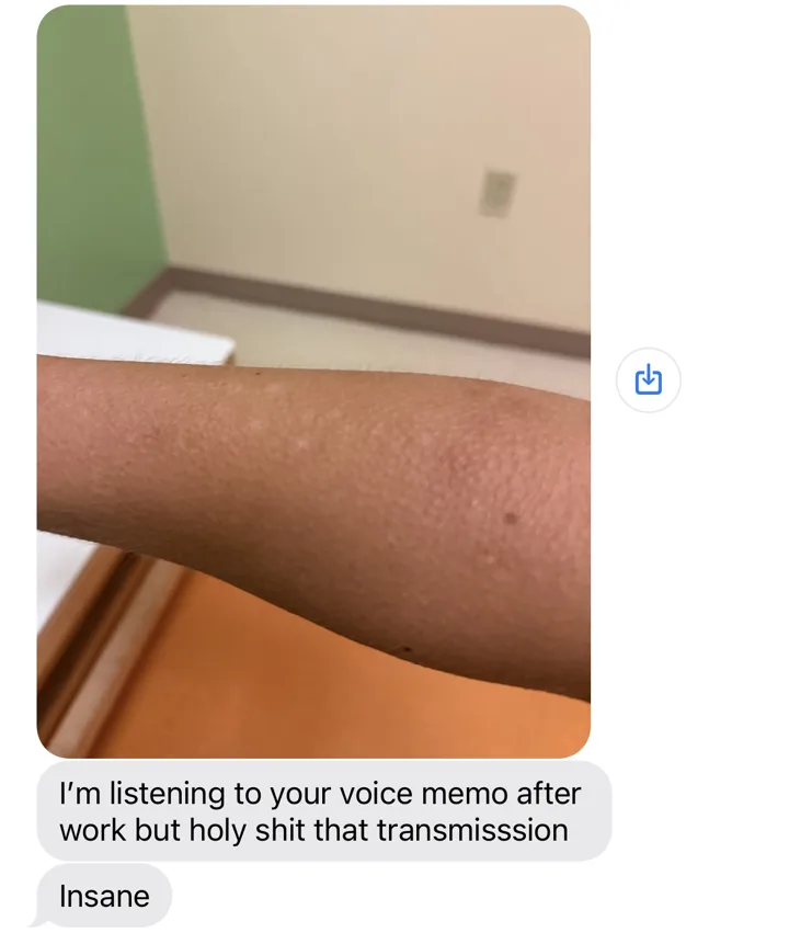 Photo of an arm covered in goosebumps with the text: I'm listening to your voice memo after work but holy shit that transmission. Insane
